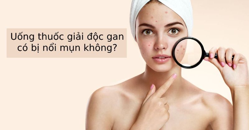 Nguyên nhân gây mụn do tích tụ độc tố trong cơ thể